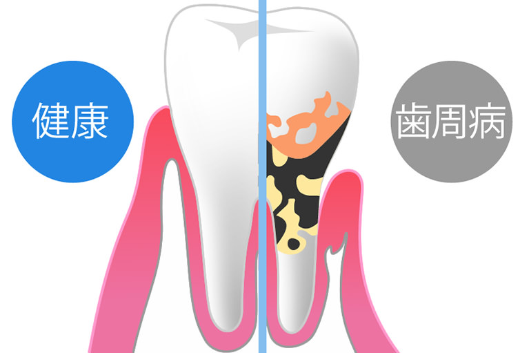 病気の成り立ち